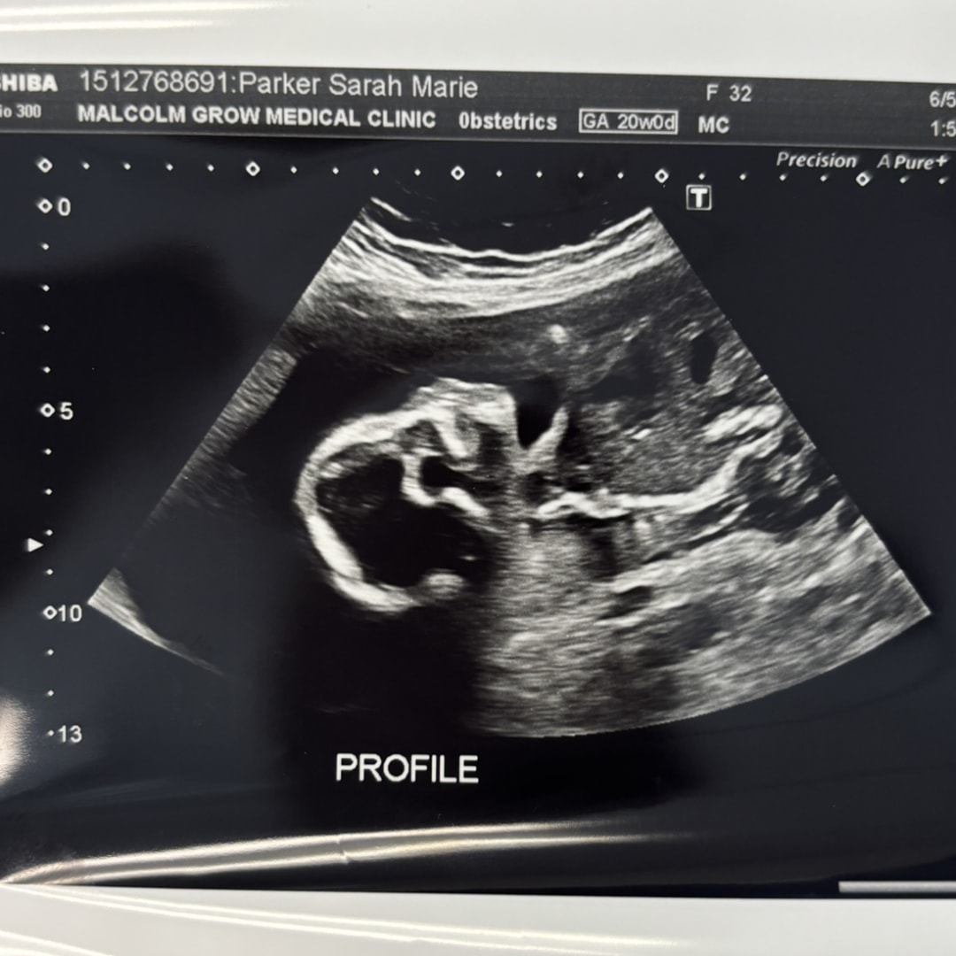 Photo shared by Sarah for their Babylist baby registry.