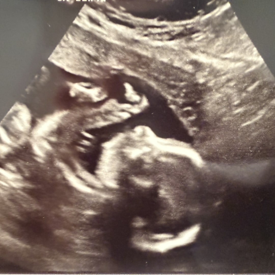 Photo shared by Mary for their Babylist baby registry.