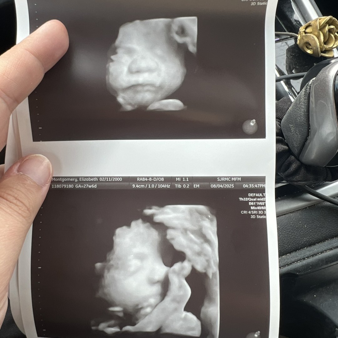 Photo shared by Lizzy for their Babylist baby registry.