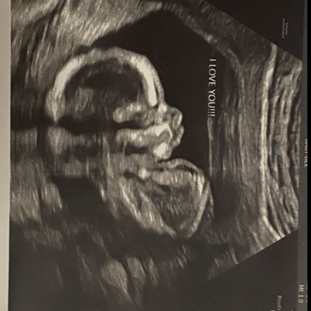 Photo shared by Alexandra for their Babylist baby registry.