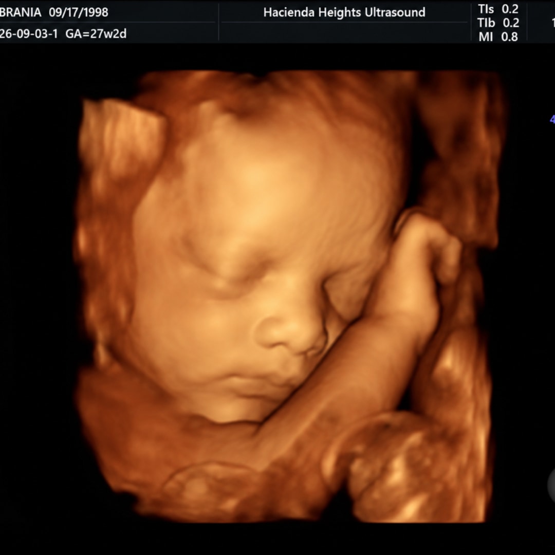 Photo shared by Briana for their Babylist baby registry.