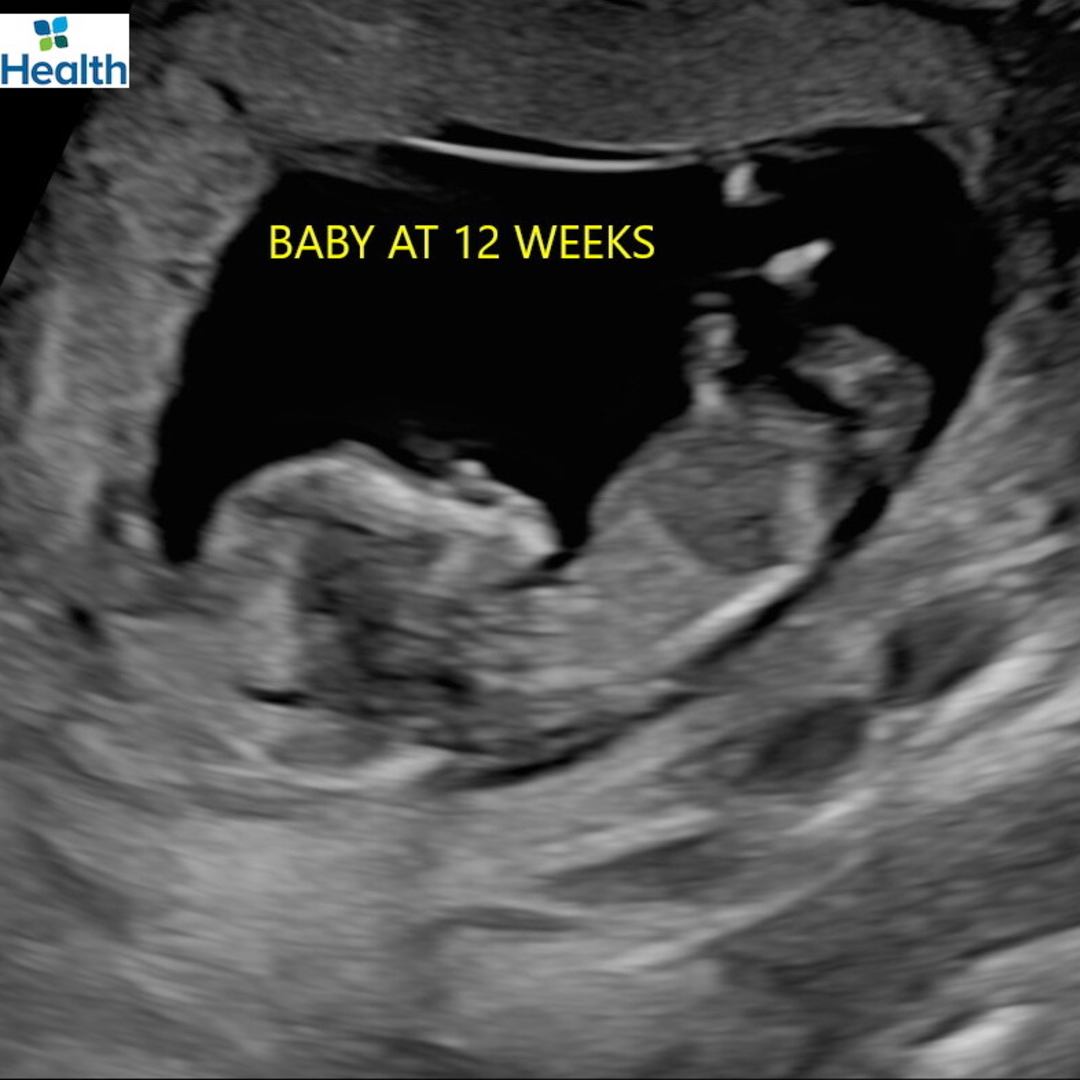 Photo shared by Brenna for their Babylist baby registry.