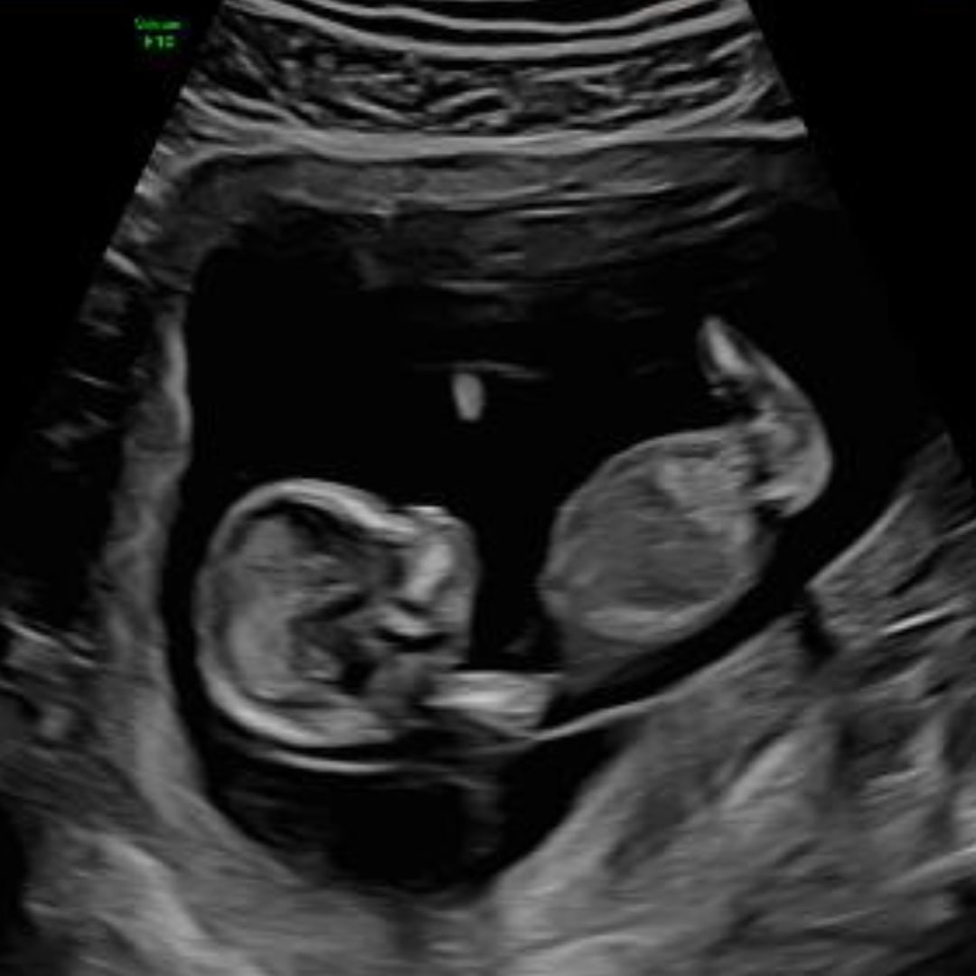 Photo shared by Gabi for their Babylist baby registry.