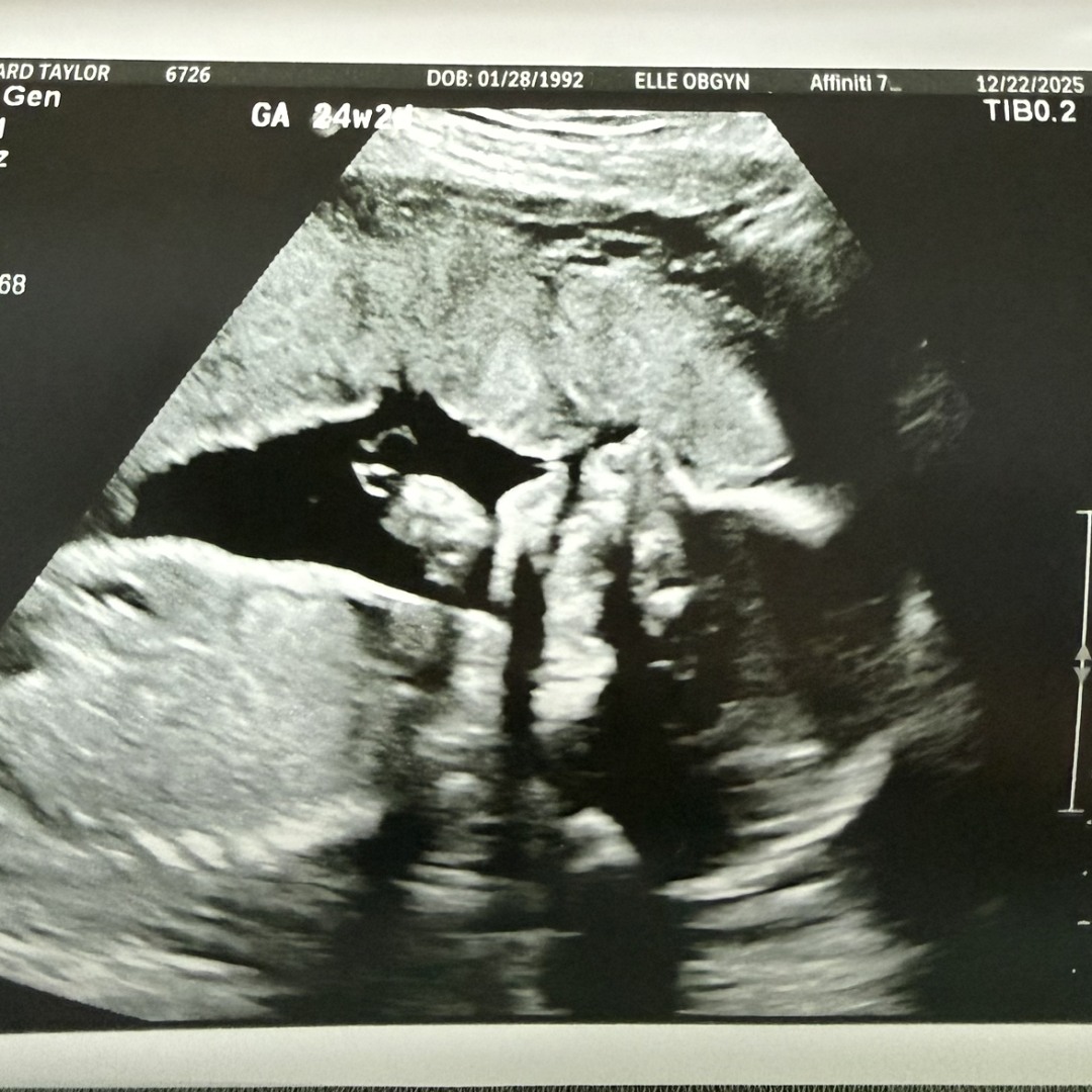 Photo shared by Taylor for their Babylist baby registry.