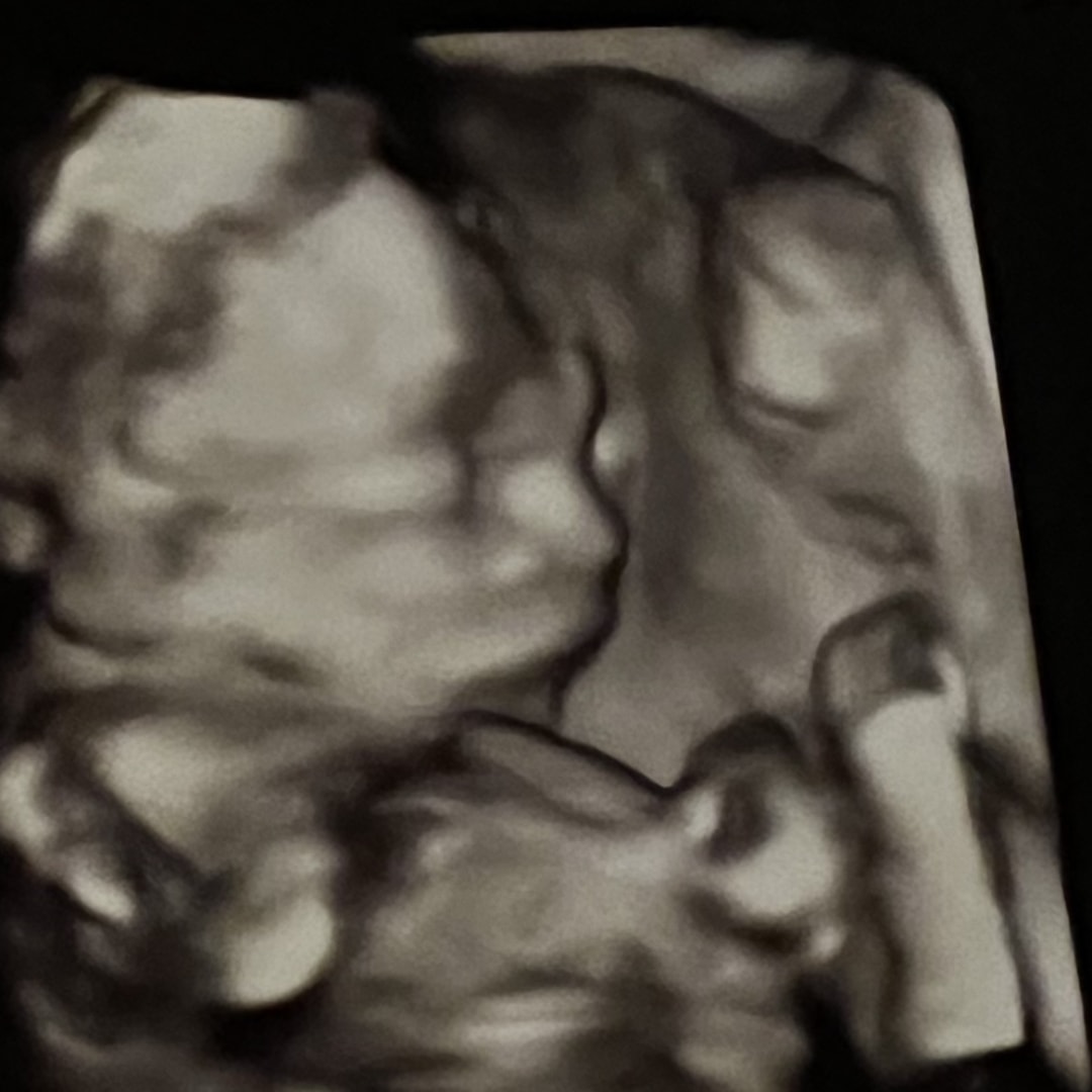 Photo shared by Alaina for their Babylist baby registry.