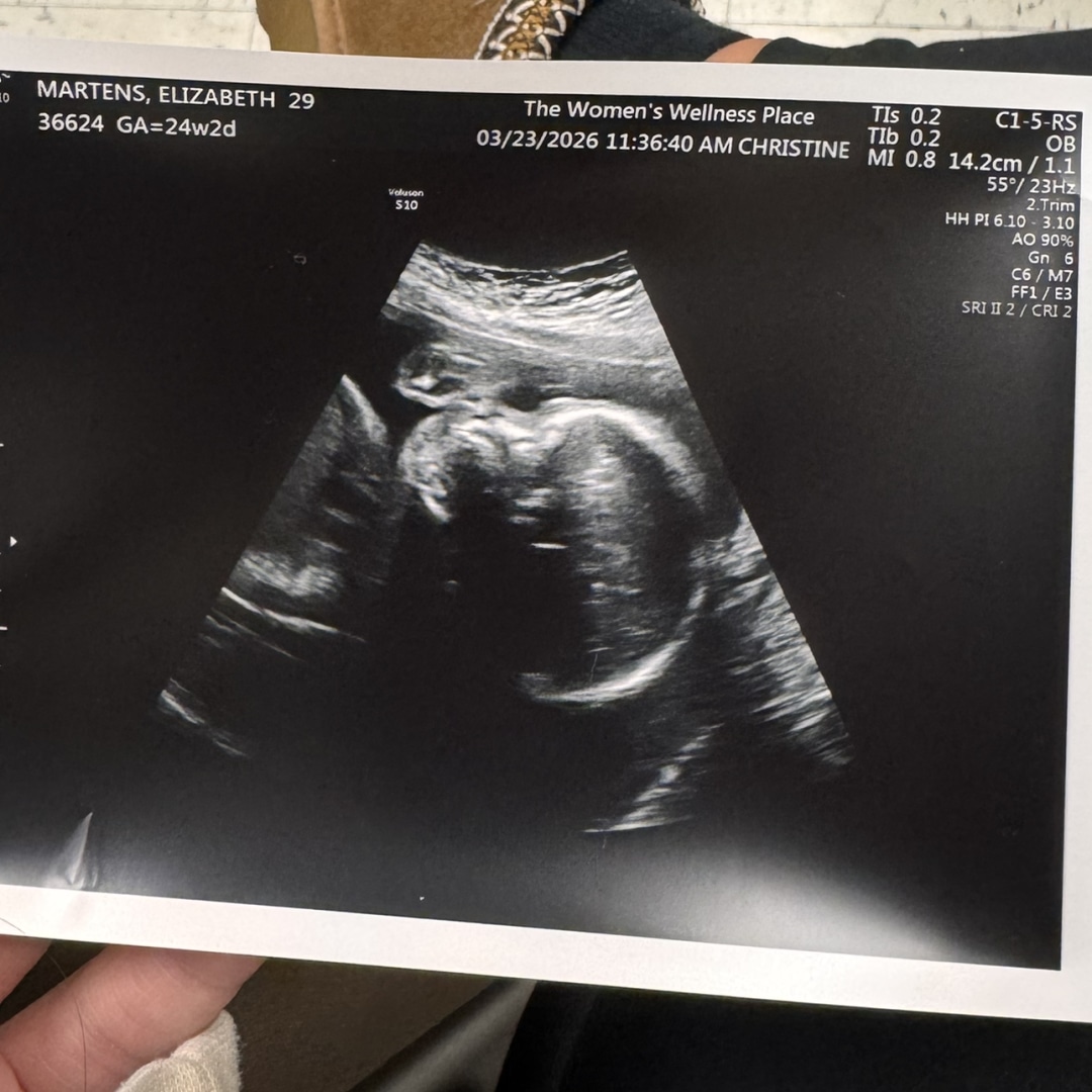 Photo shared by Elizabeth for their Babylist baby registry.