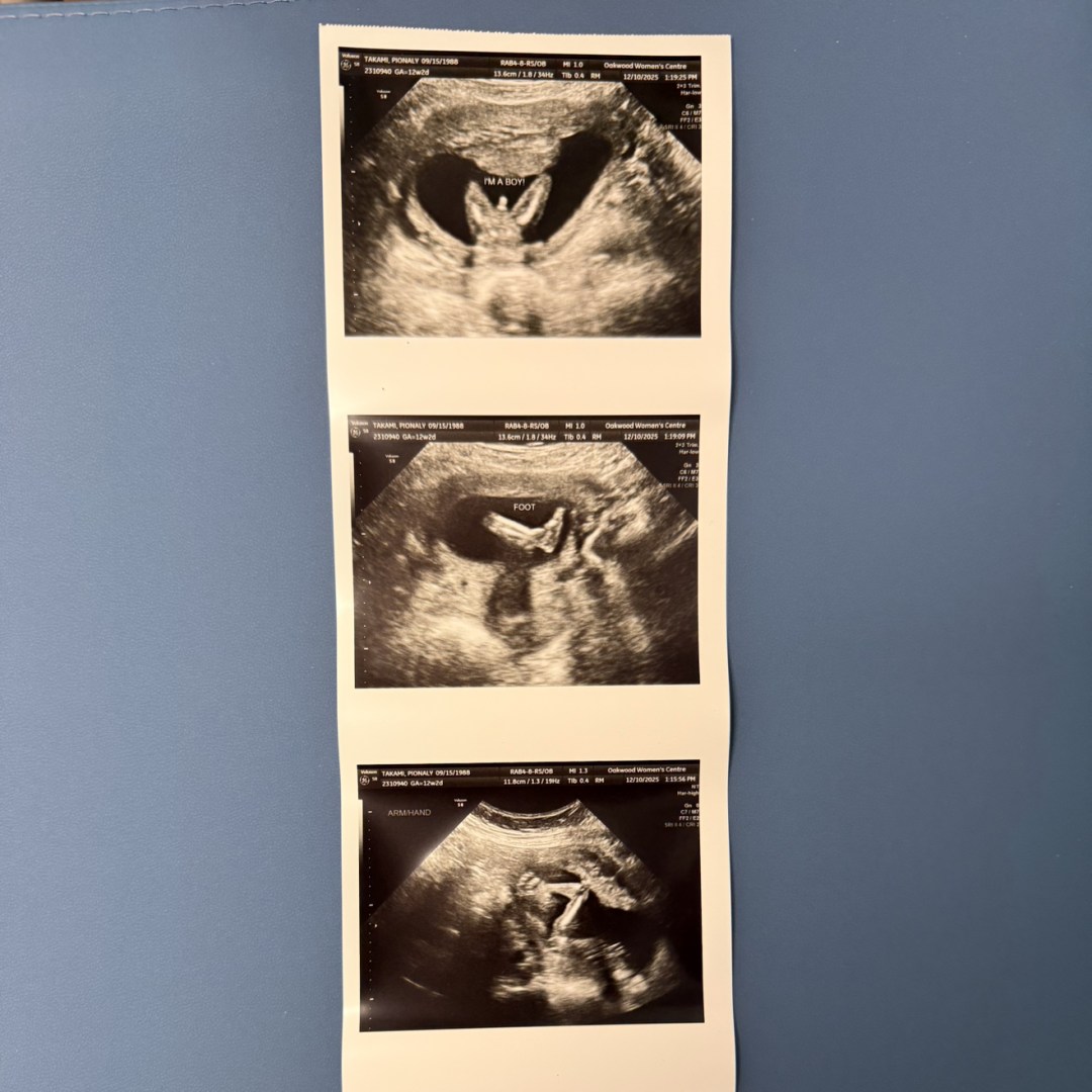 Photo shared by Pionaly for their Babylist baby registry.