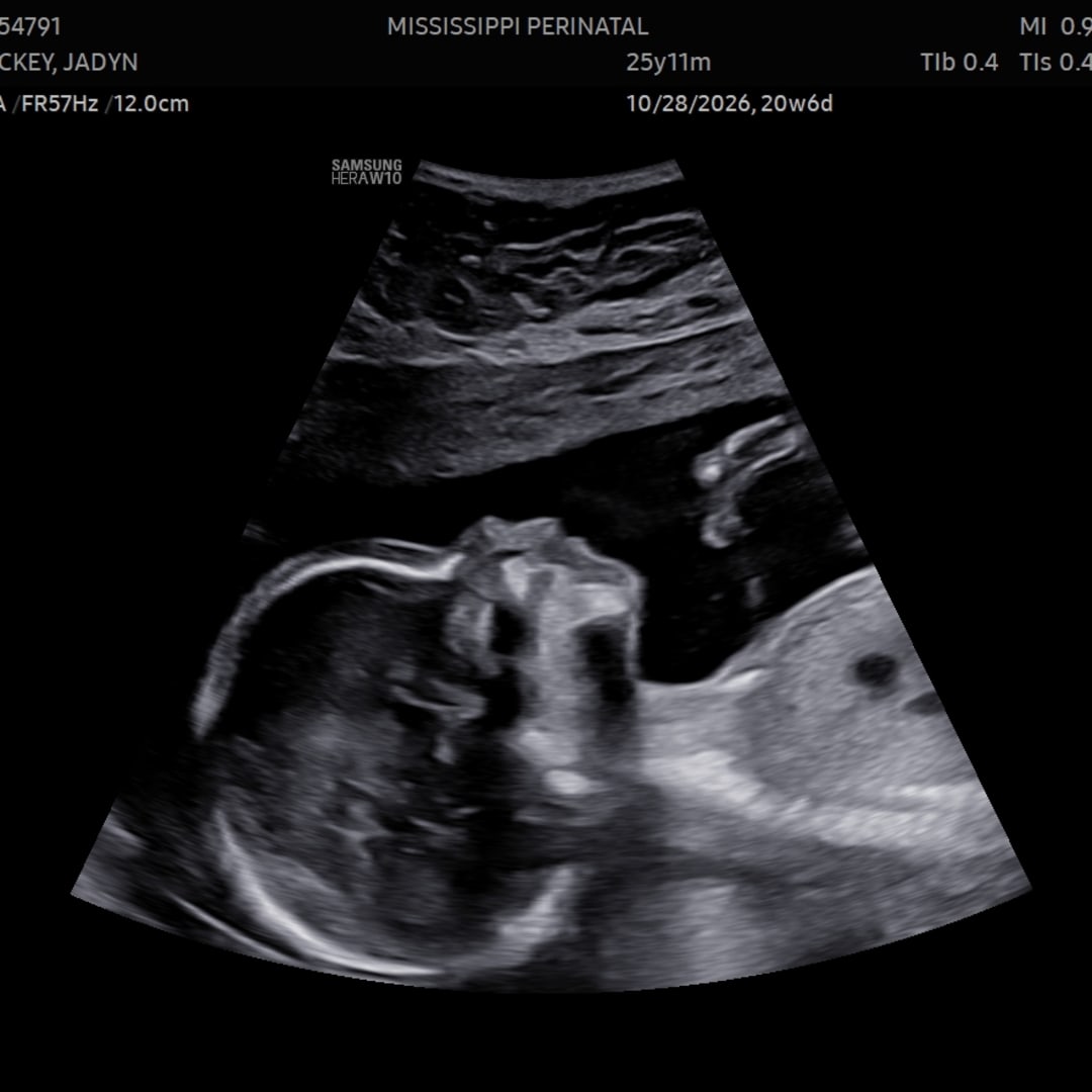 Photo shared by Jadyn for their Babylist baby registry.