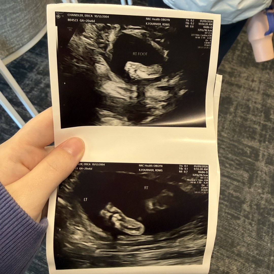 Photo shared by Erica for their Babylist baby registry.