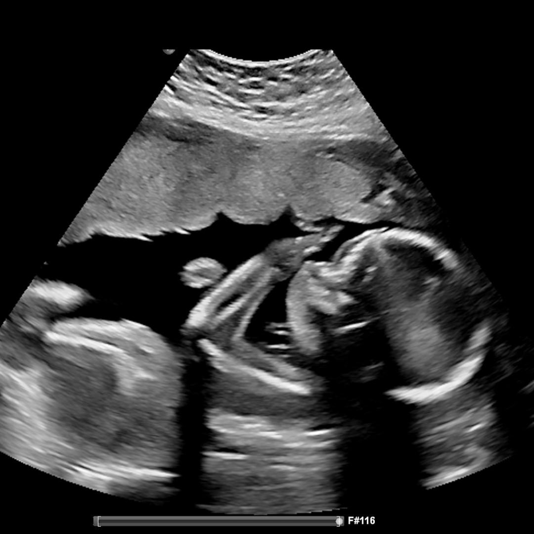 Photo shared by Lyza for their Babylist baby registry.