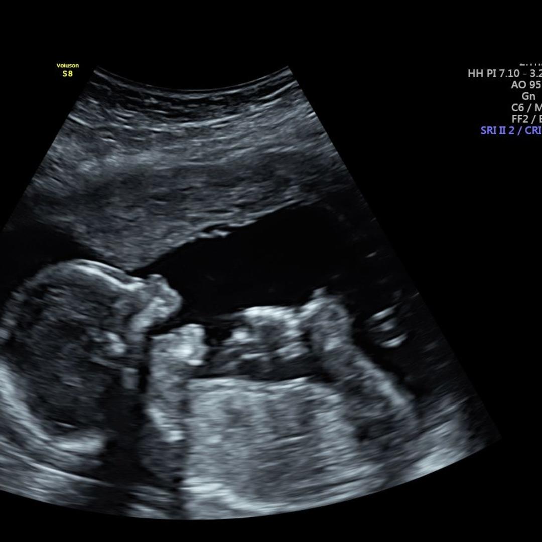 Photo shared by Malinda for their Babylist baby registry.