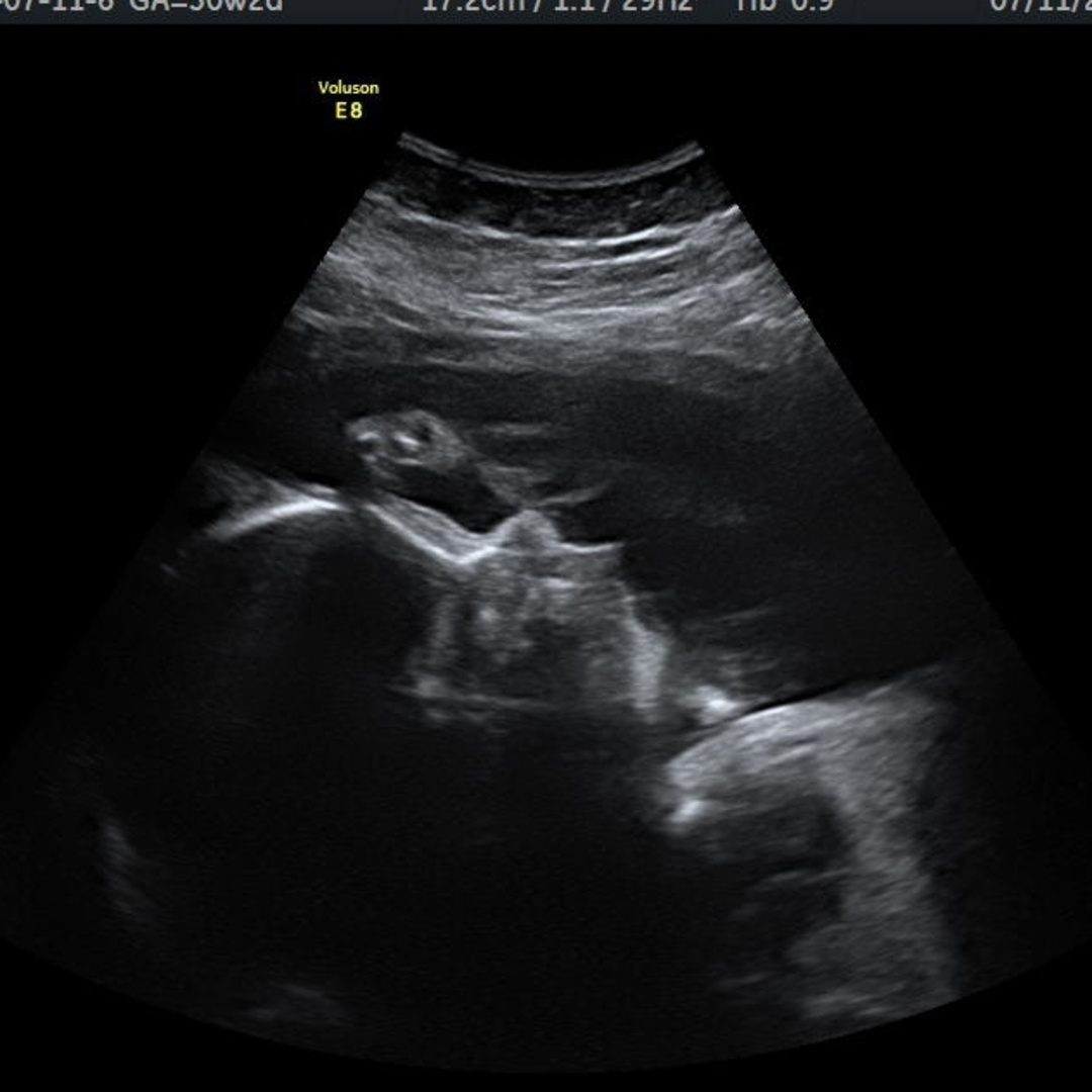Photo shared by Alexis for their Babylist baby registry.