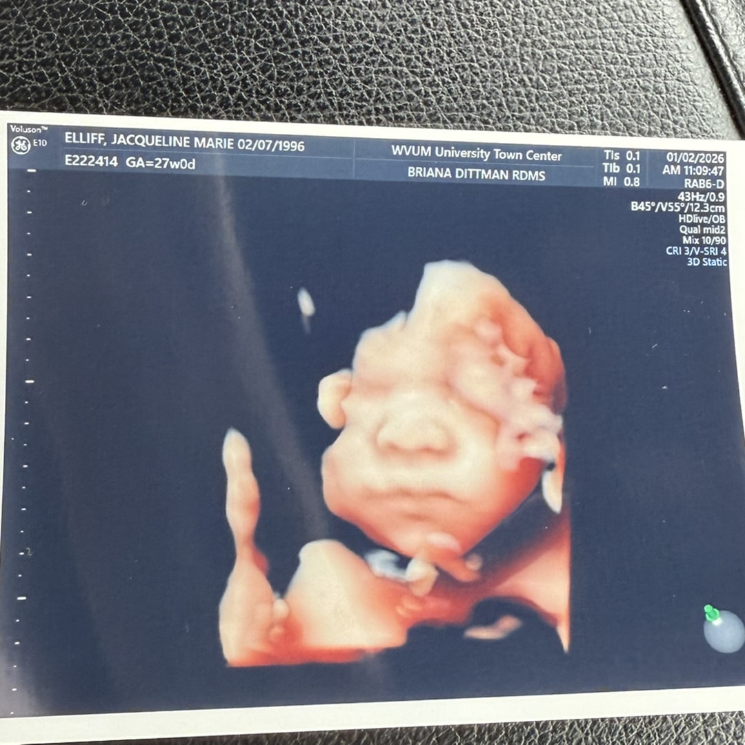 Photo shared by Jacqueline for their Babylist baby registry.