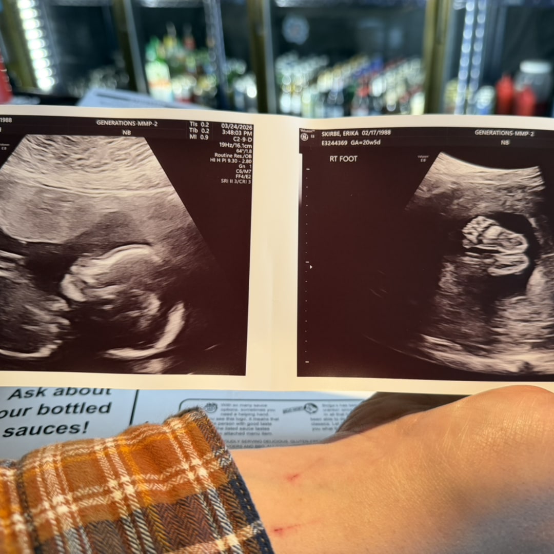 Photo shared by Erika for their Babylist baby registry.