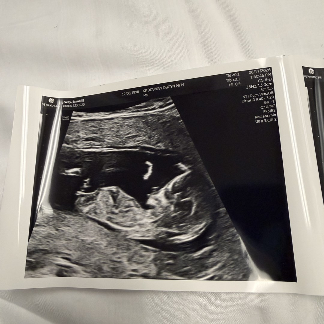 Photo shared by DeAngelo for their Babylist baby registry.
