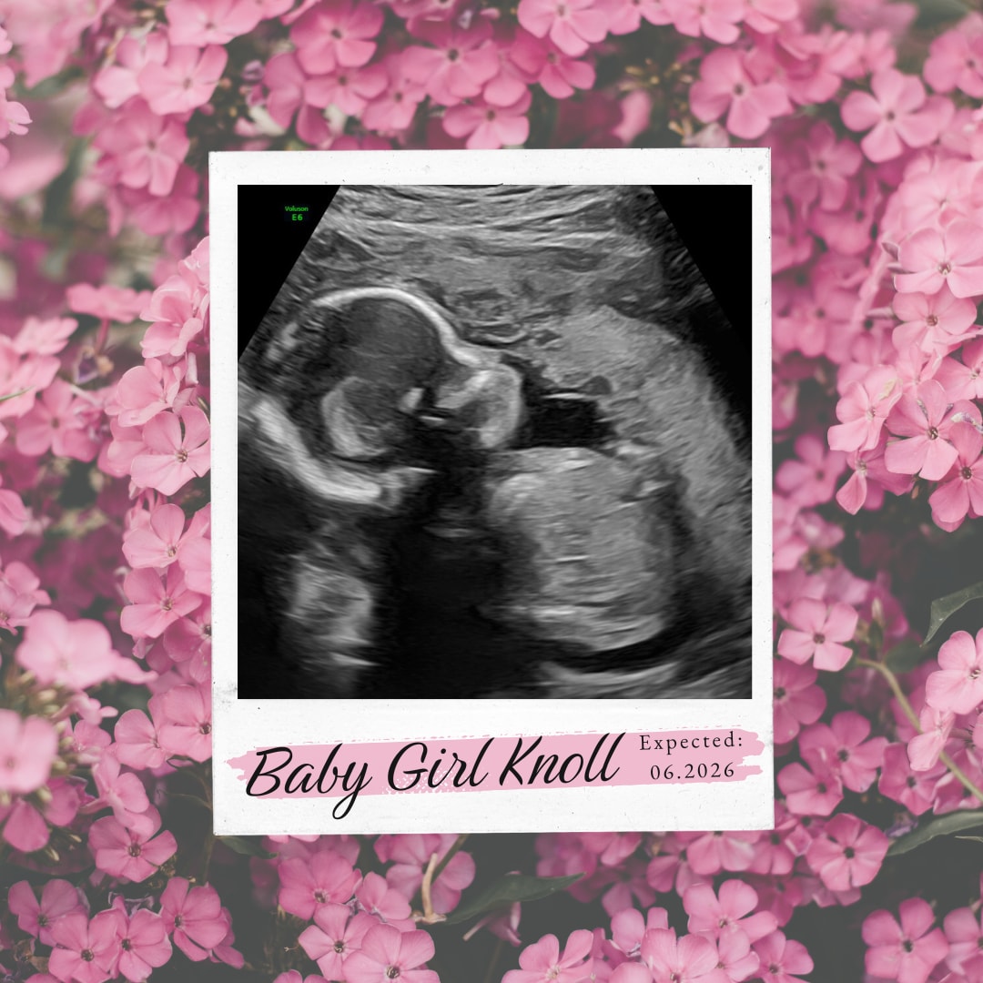 Photo shared by Ally for their Babylist baby registry.