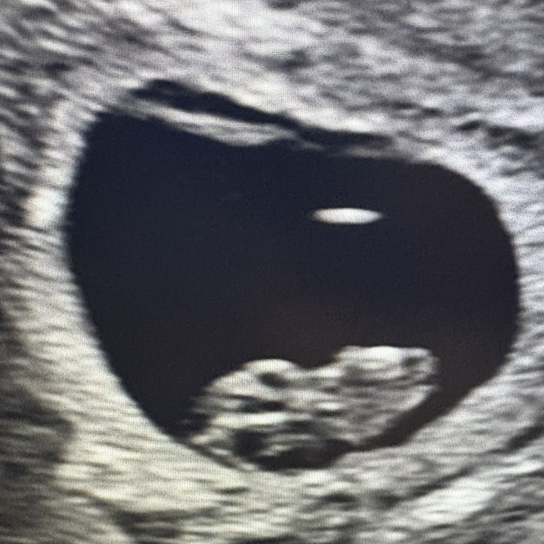 Photo shared by Hailey for their Babylist baby registry.