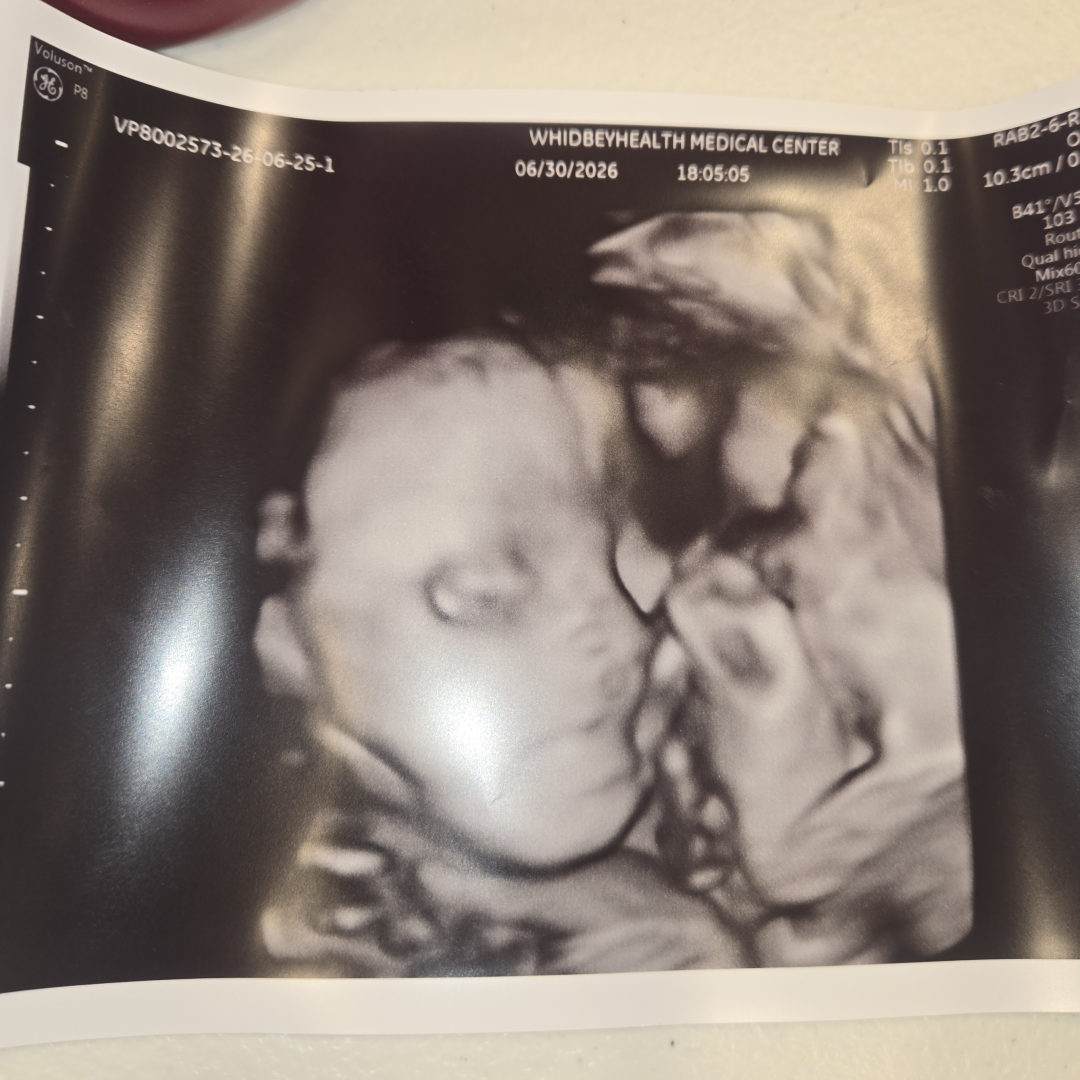 Photo shared by Lena for their Babylist baby registry.