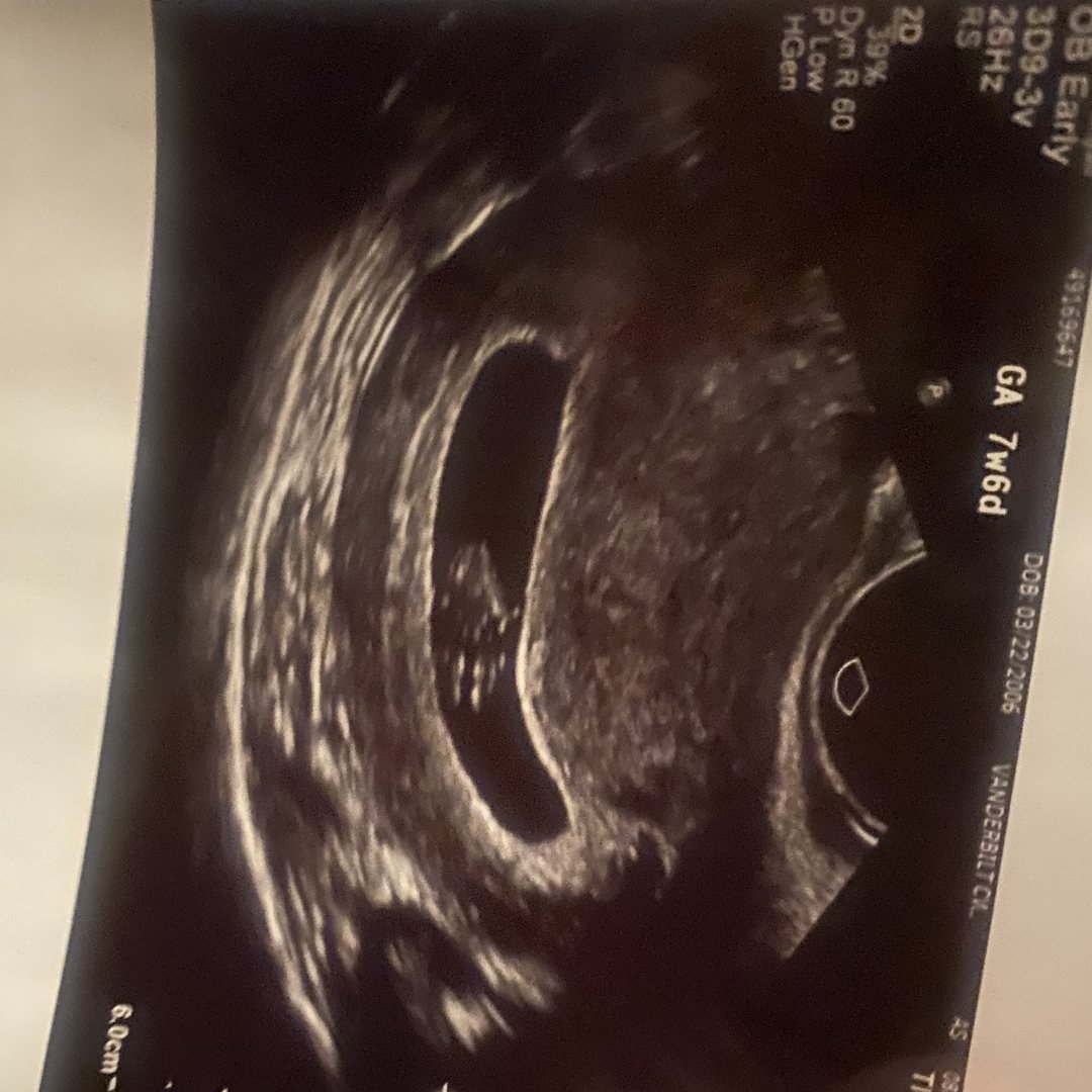 Photo shared by Abigail for their Babylist baby registry.