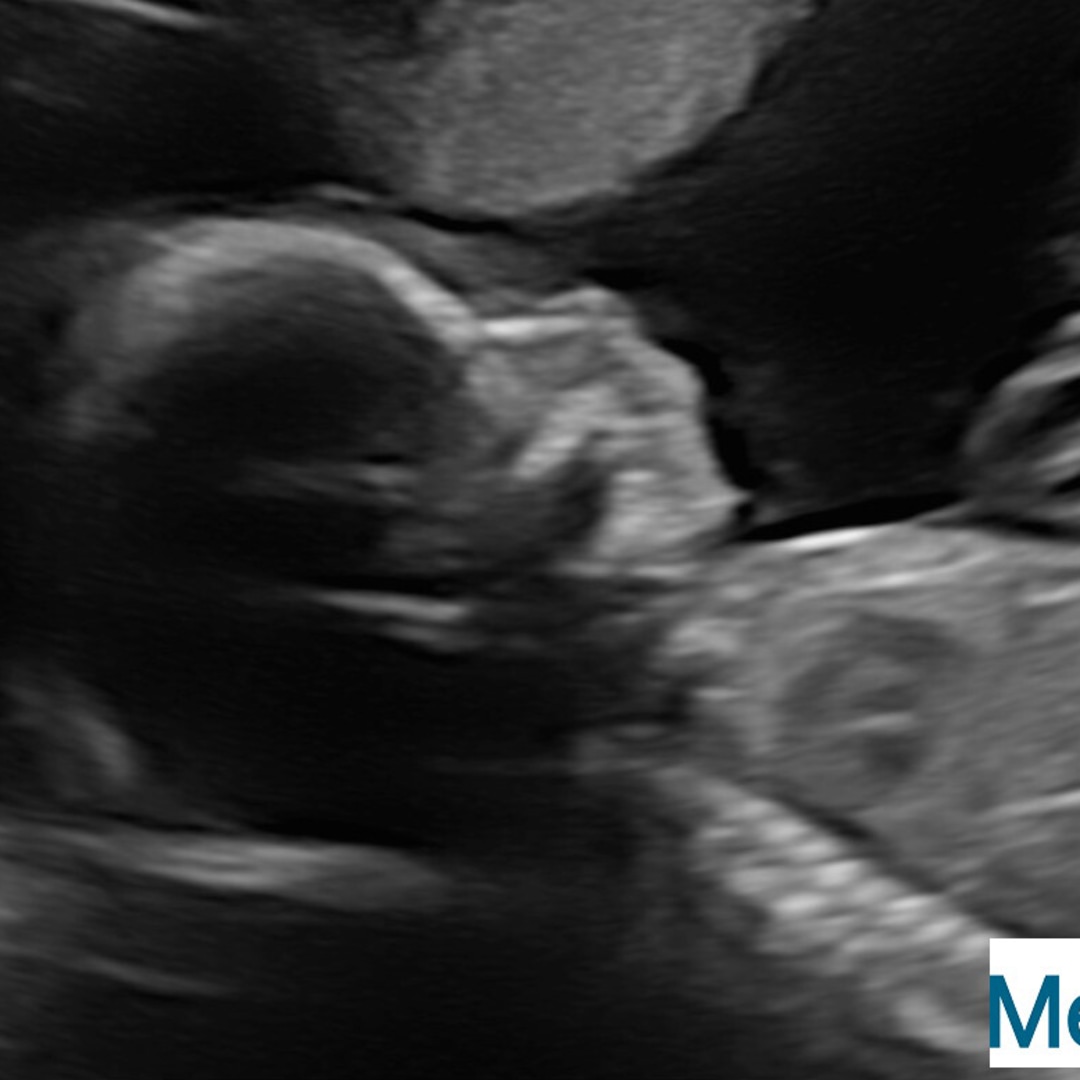 Photo shared by Hannah for their Babylist baby registry.