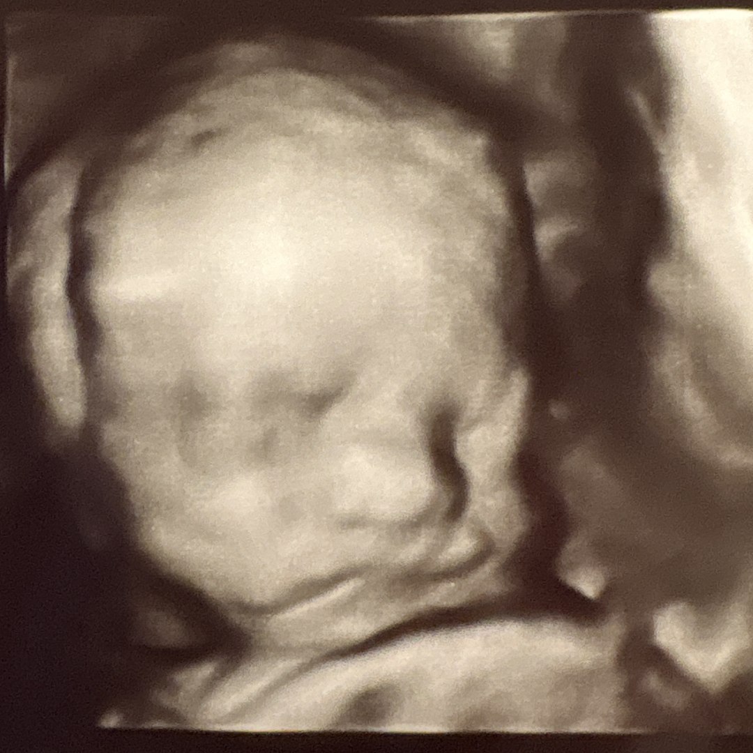 Photo shared by Laney for their Babylist baby registry.