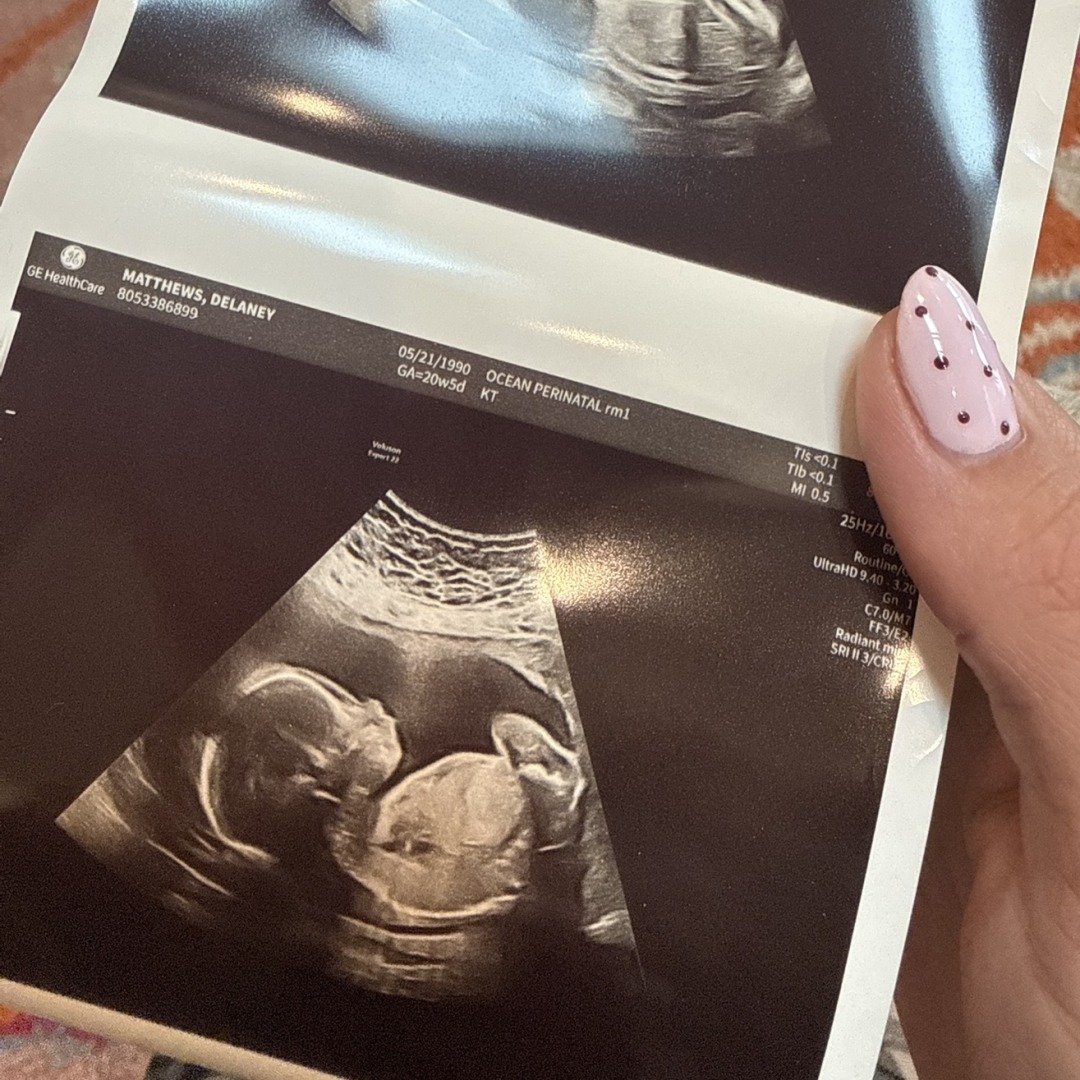 Photo shared by Delaney for their Babylist baby registry.