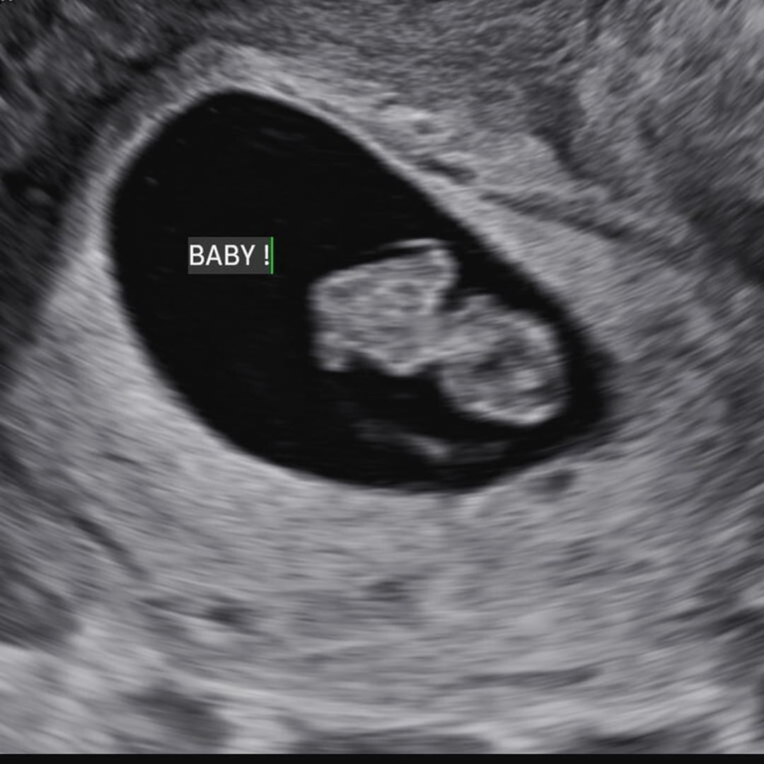 Photo shared by Marri for their Babylist baby registry.