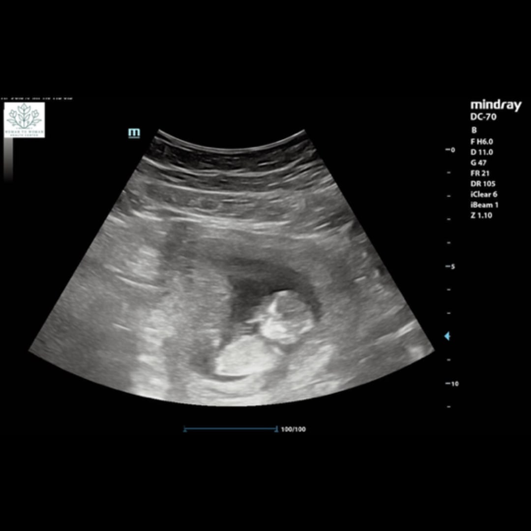 Photo shared by Brooke for their Babylist baby registry.