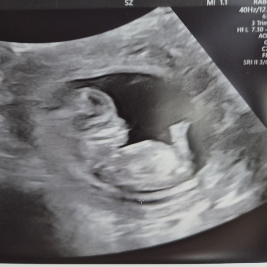 Photo shared by Valerie for their Babylist baby registry.