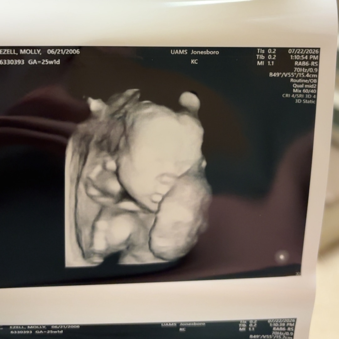 Photo shared by Molly for their Babylist baby registry.