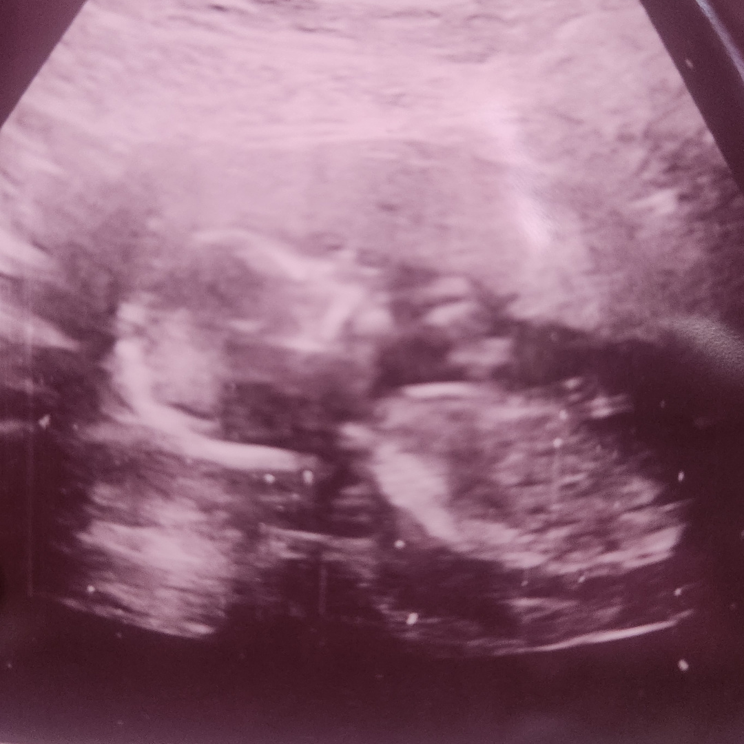 Photo shared by Jennifer for their Babylist baby registry.