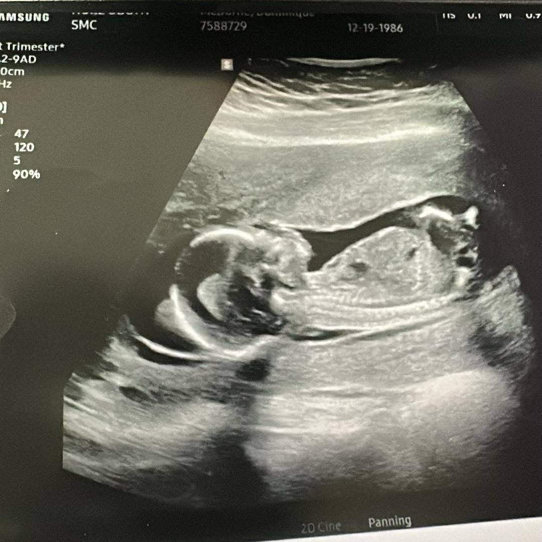 Photo shared by Dominique for their Babylist baby registry.