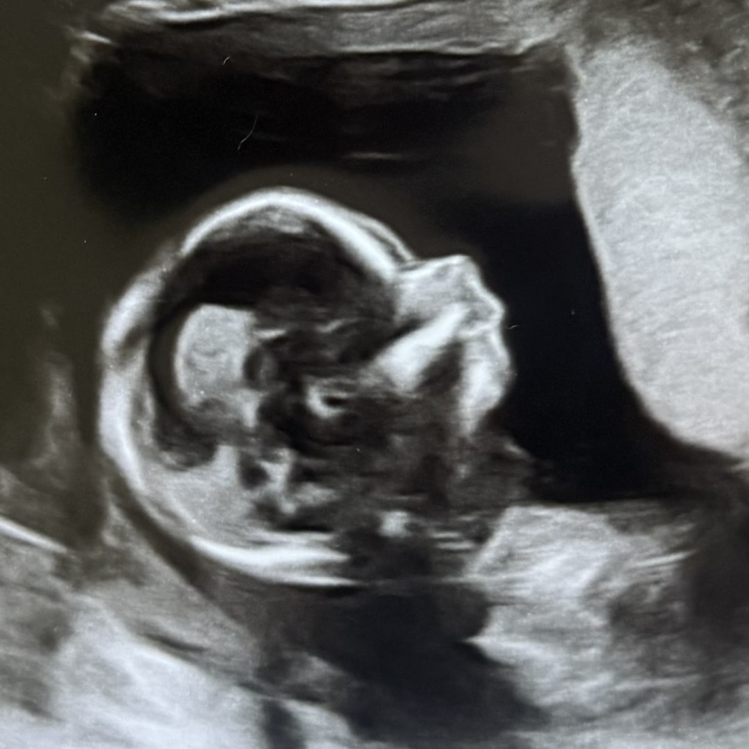 Photo shared by Lindsey for their Babylist baby registry.