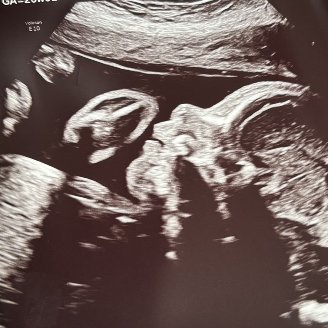 Photo shared by Chelzi for their Babylist baby registry.