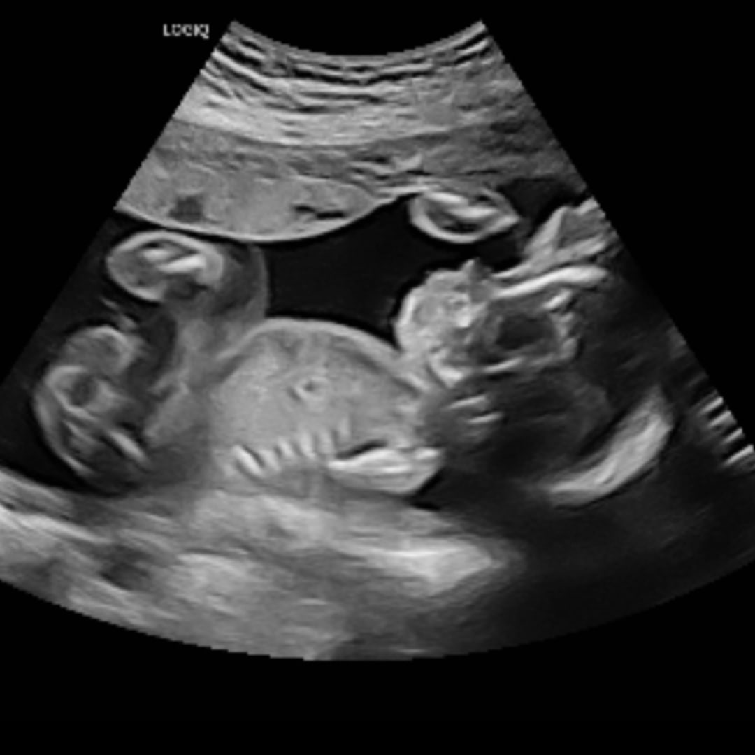 Photo shared by Mckenzie for their Babylist baby registry.