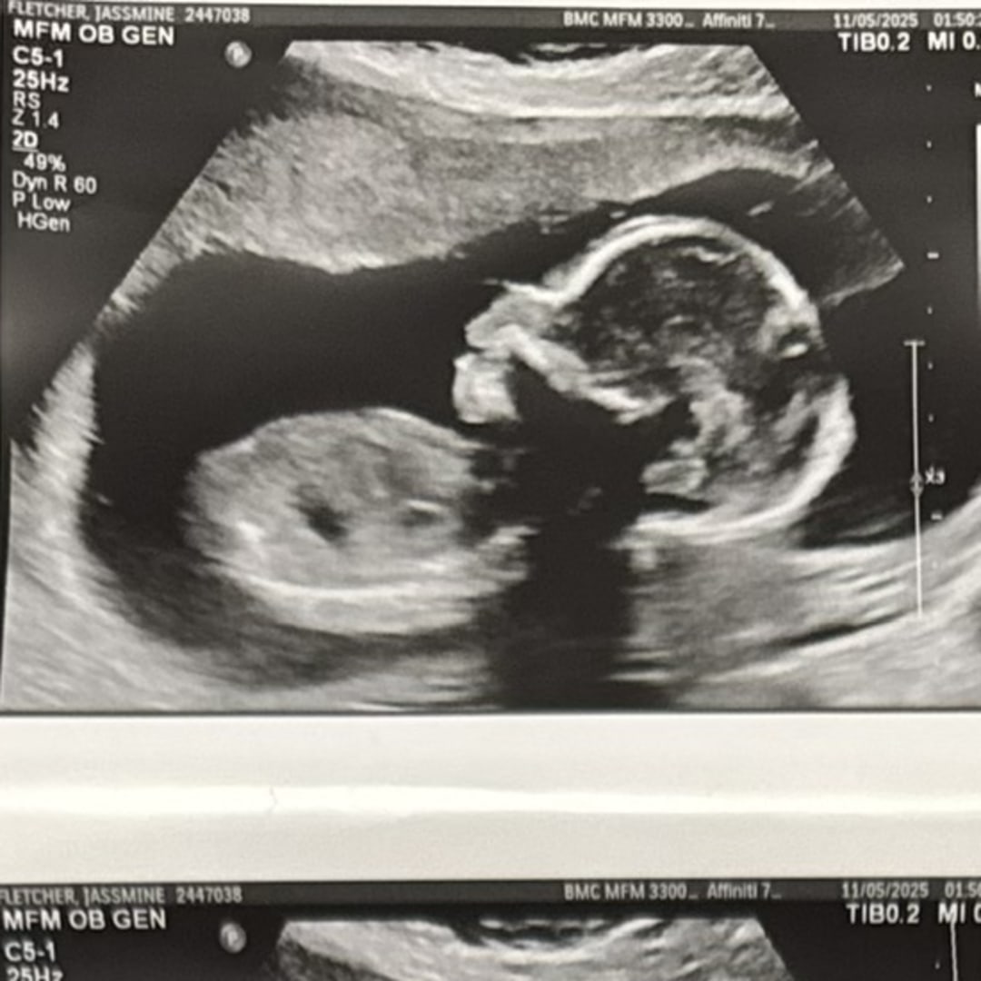 Photo shared by Jassmine for their Babylist baby registry.