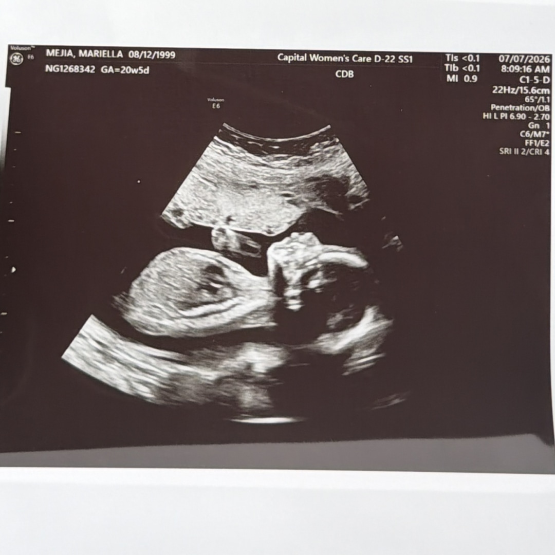 Photo shared by Mariella for their Babylist baby registry.