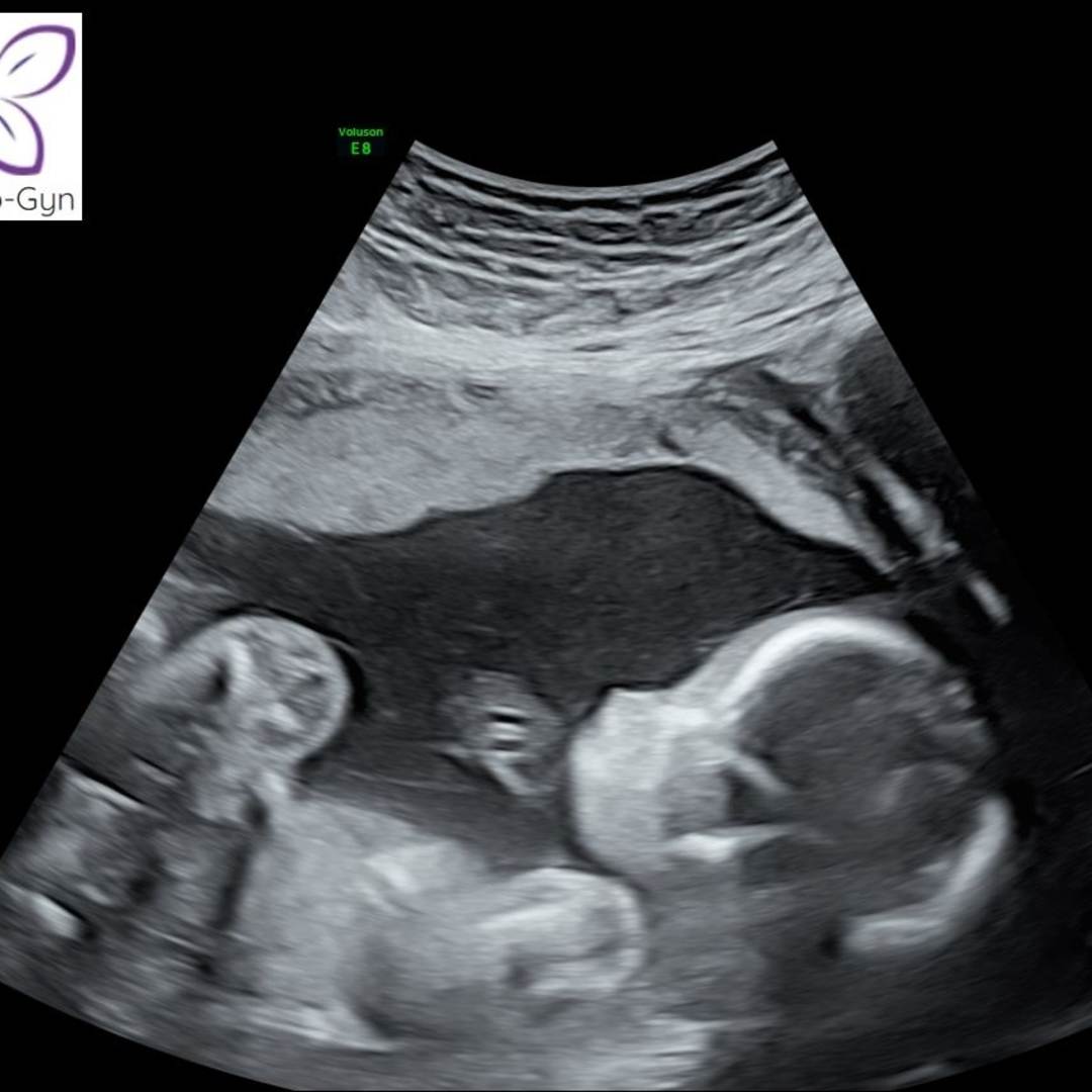 Photo shared by Angelica for their Babylist baby registry.