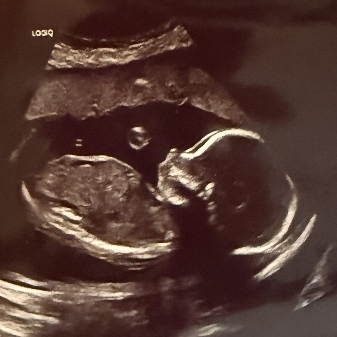 Photo shared by Zakarryah for their Babylist baby registry.