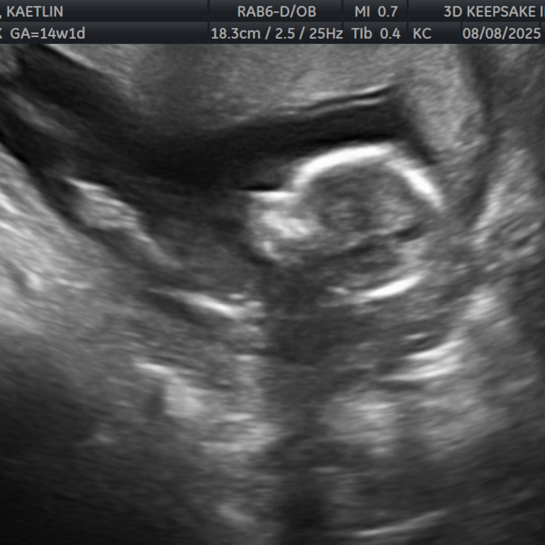 Photo shared by Kate for their Babylist baby registry.