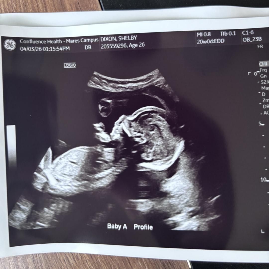 Photo shared by Shelby for their Babylist baby registry.