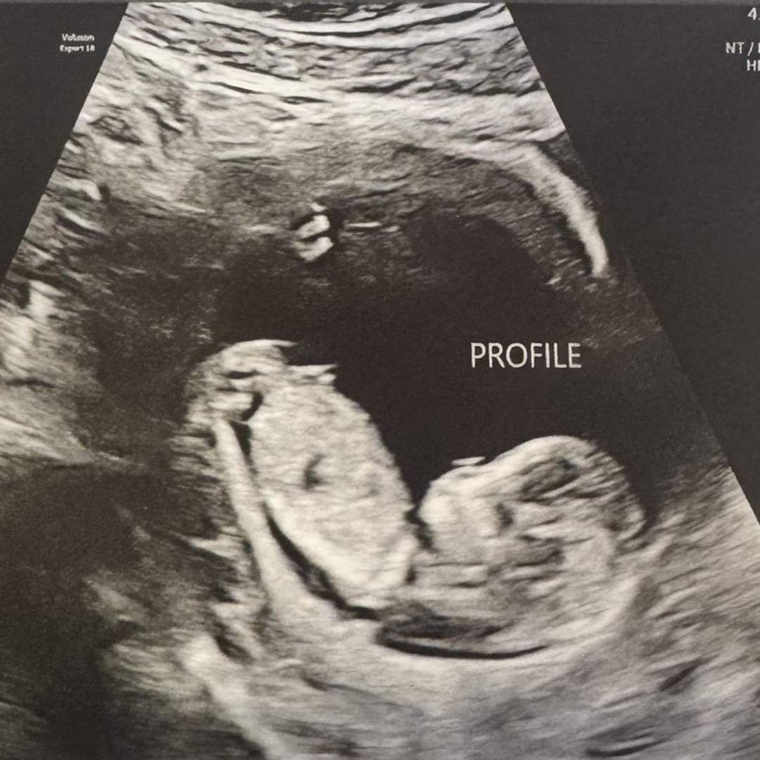 Photo shared by Ellie for their Babylist baby registry.