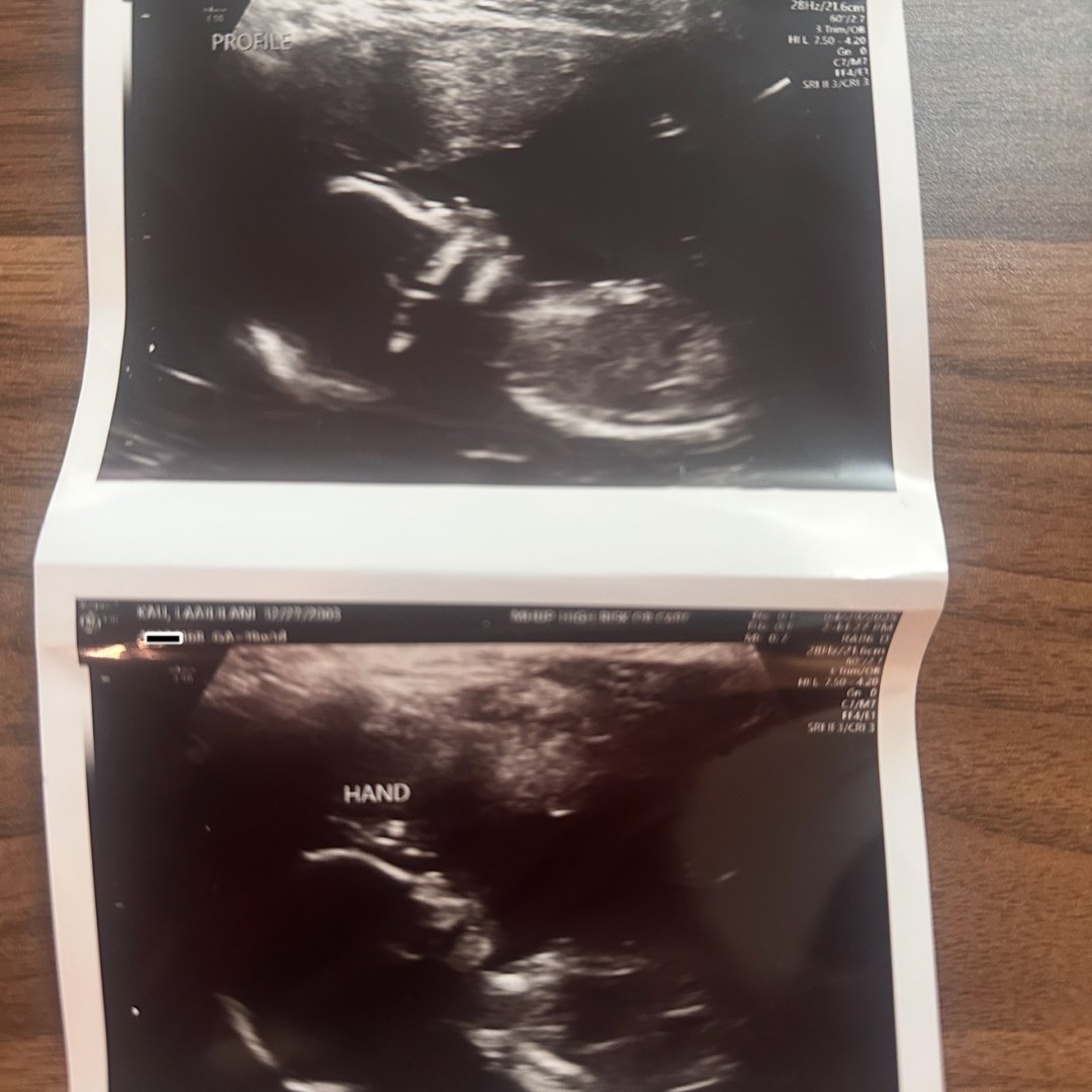 Photo shared by Laaililani for their Babylist baby registry.