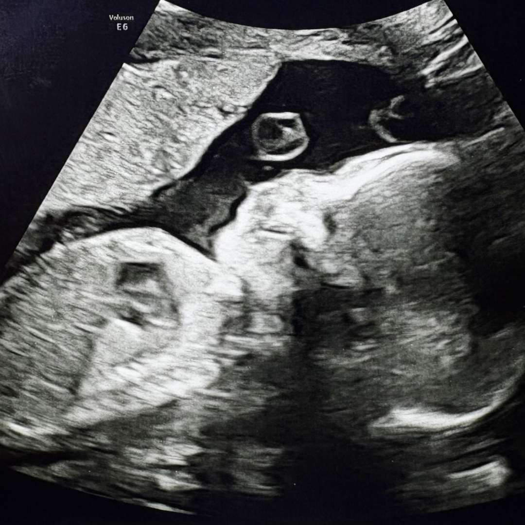 Photo shared by Daniel for their Babylist baby registry.