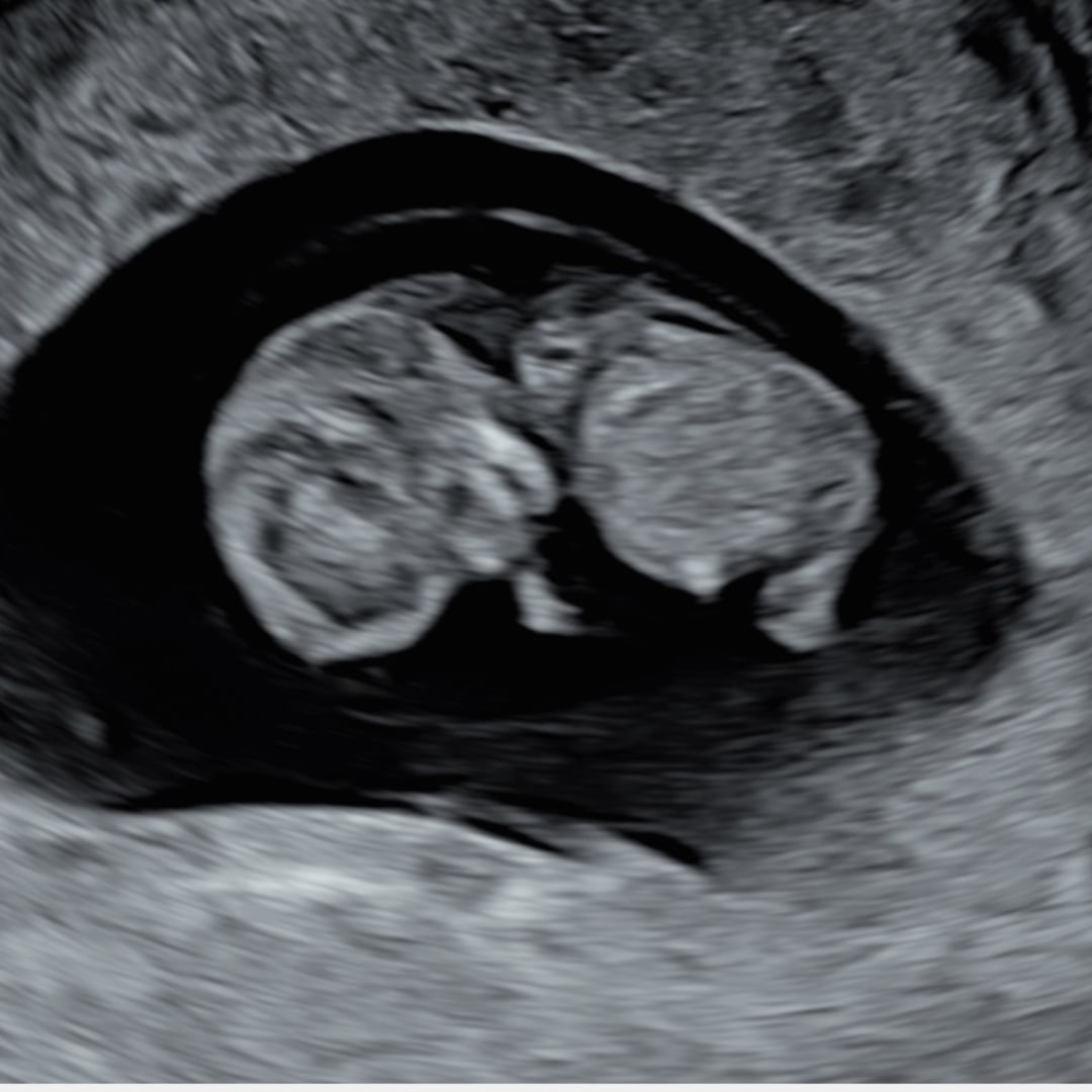 Photo shared by Brittany for their Babylist baby registry.