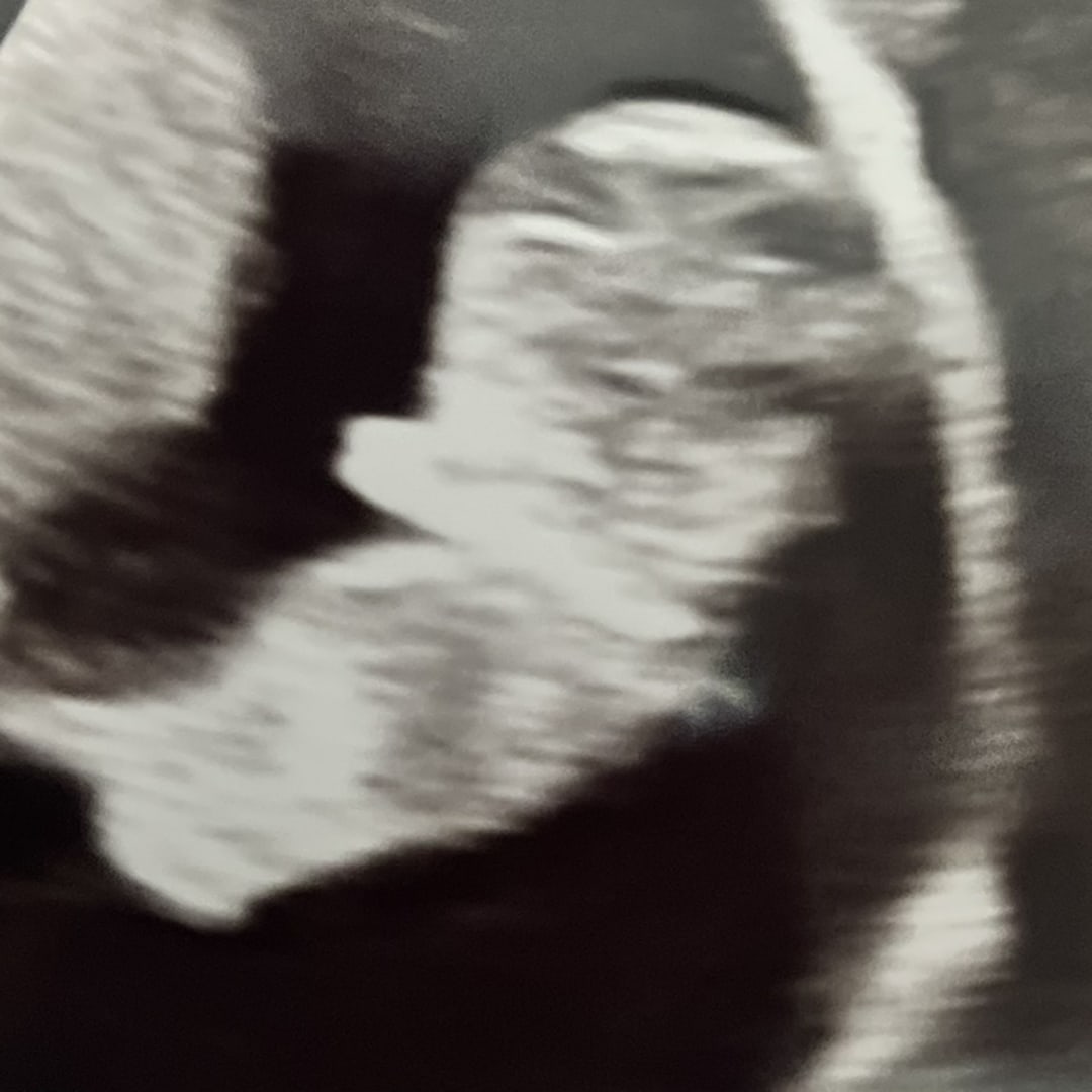 Photo shared by Rochelle for their Babylist baby registry.