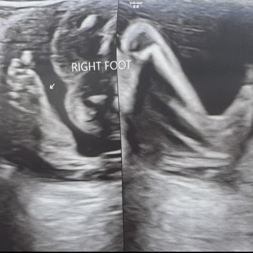 Photo shared by Kennedy for their Babylist baby registry.