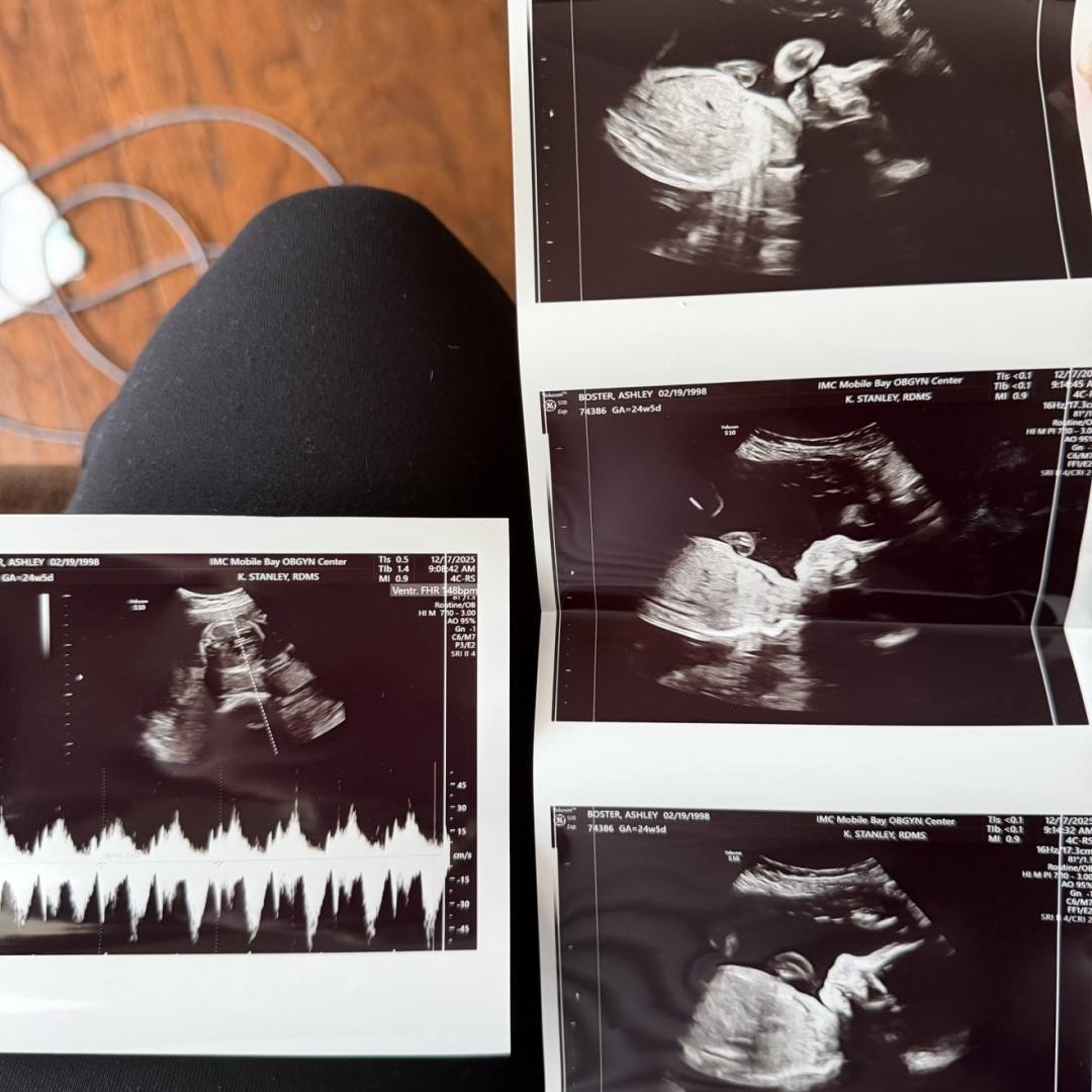 Photo shared by Ashley for their Babylist baby registry.