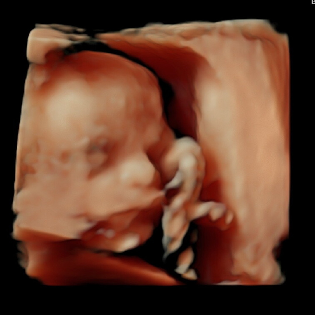 Photo shared by Jaimee for their Babylist baby registry.