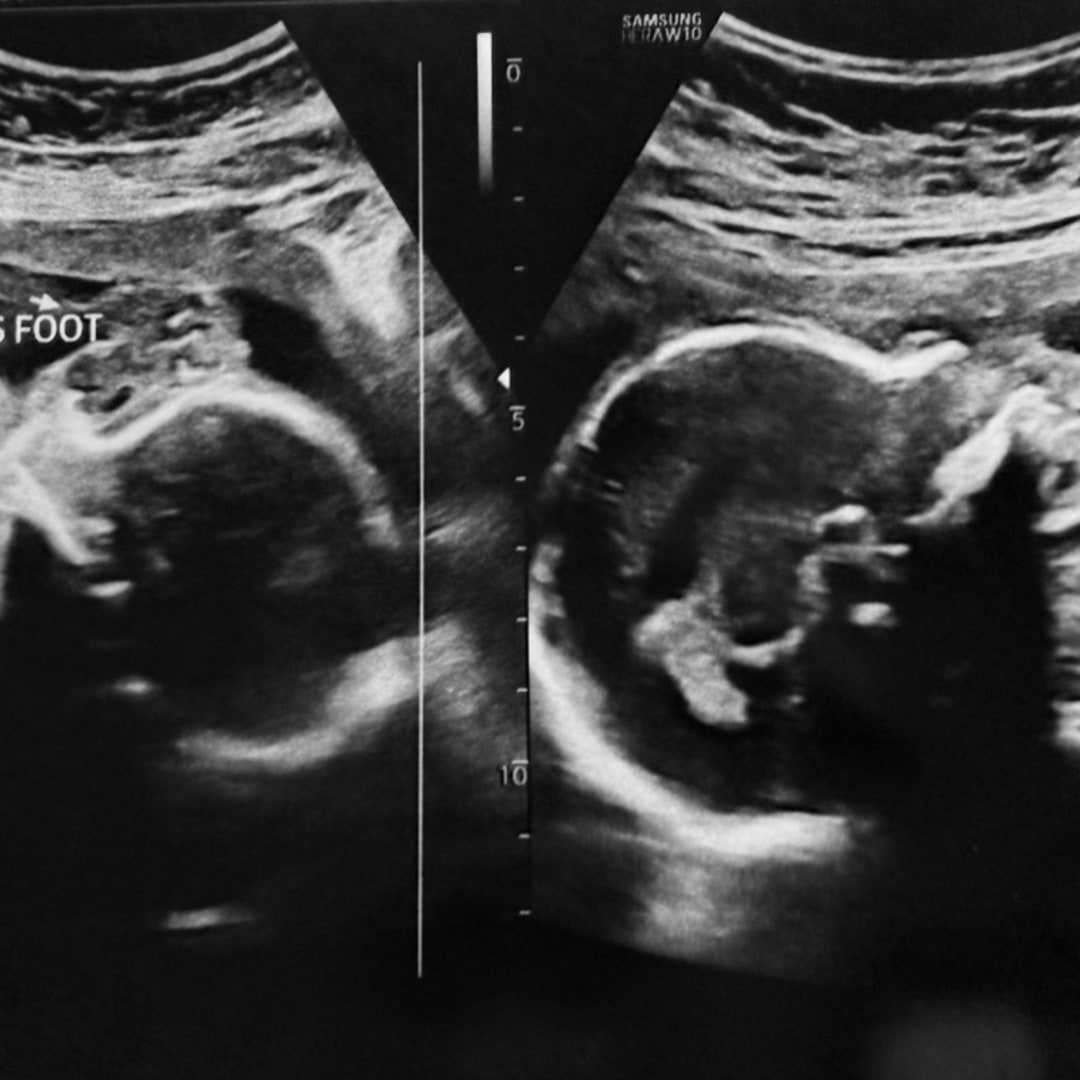 Photo shared by Jessica for their Babylist baby registry.